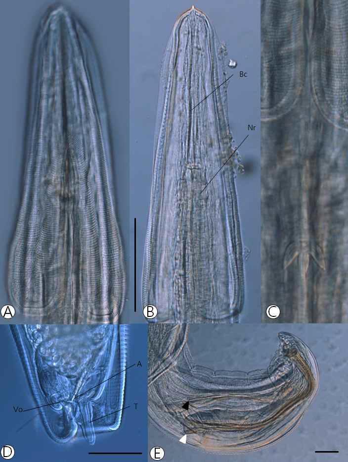 Light microscopic view of Desportesius invaginatus A-B: Head part of the worm