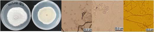 Morphology of the isolate KNU13-2(Pseudallescheria boydii) on potato dextrose agar(PDA)