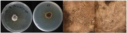 Morphology of the isolate KNU13-5(Mortierella alpina) on potato dextrose agar(PDA)