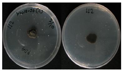 Morphology of the isolate KNU13-9(Scolecobasidium terreum) on potato dextrose agar(PDA)