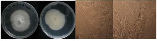 Morphology of the isolate KNU13-10(Thielavia terricola) on potato dextrose agar(PDA)