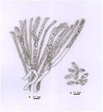 Micromorphological charcters of Sarcoscypha occidentalis for. occidentalis. a. Ascuspores; b. Asci and paraphyses.