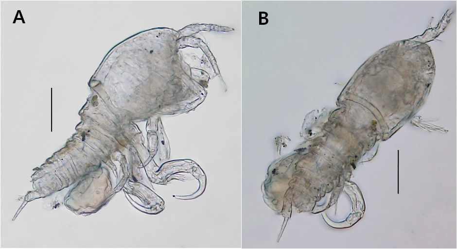 Robustunguis sp., female. A, habitus, lateral; B, habitus, dorsal. Scales: 0.1mm in all.