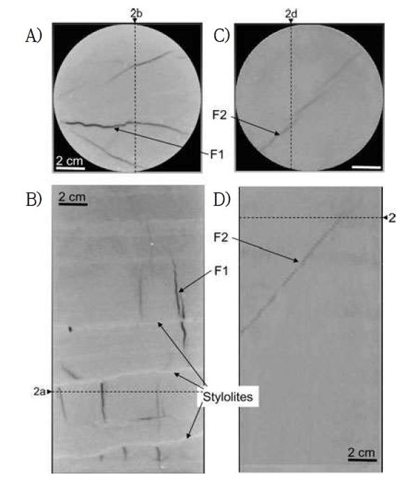 Fracture of sample 1 (A and B) and sample 2 (C, D)