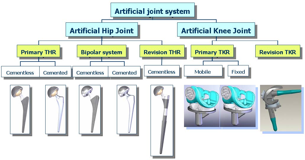 인공 고관절 및 슬관절의 유형