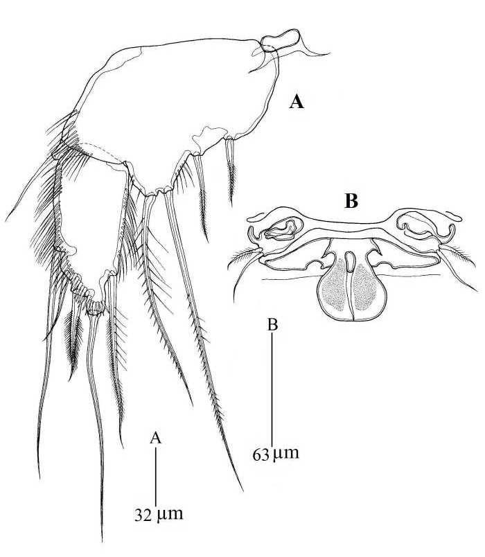 Zaus wonchoelleei sp. nov. 암컷.