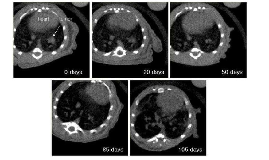 Micro CT images of PC9 cancer cell inoculated into mouse chest during oral administration of Tarceva. One of complete regression case, tumor mass was disappeared after long drug exposure time.