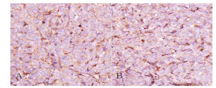 Microscopic features of the tumor in mouse lung.