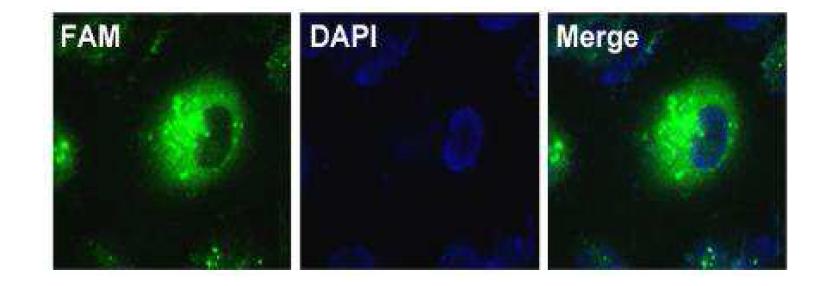 Confocal laser microscopy images of PC3 cells transfected with ternary complexes.