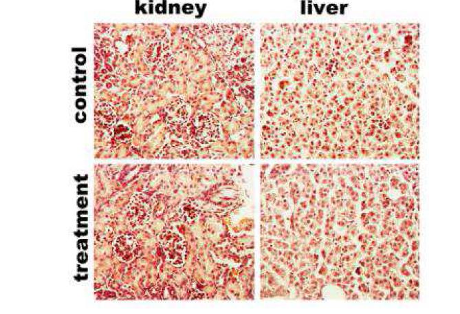 Histological analysis of mouse kidney and liver treated with ternary complexes prepared at 60 pmol/g, 2days after(H&E).