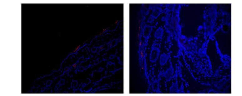 Skin (mouse food- pad) penetration experiments using ternary complexes, 24h after skin treatment