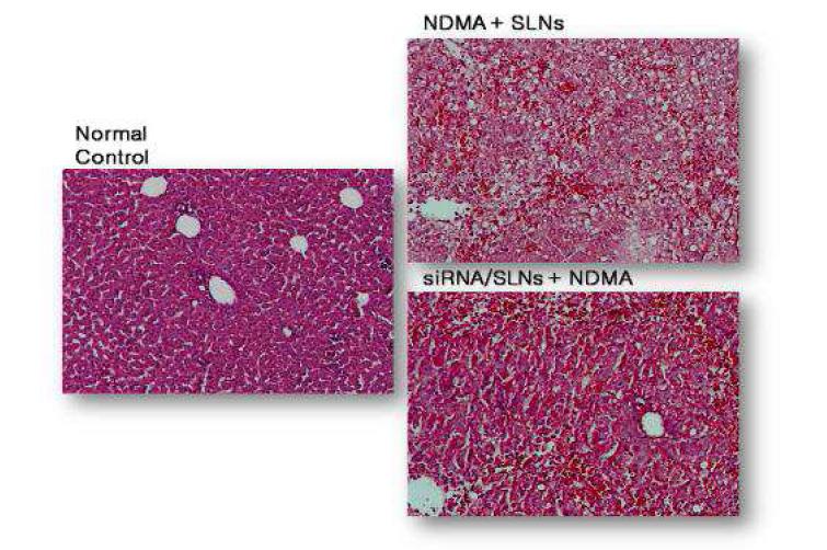 H&E staining of rat liver during NDMA- induced hepatic fibrosis and after concurrent administration