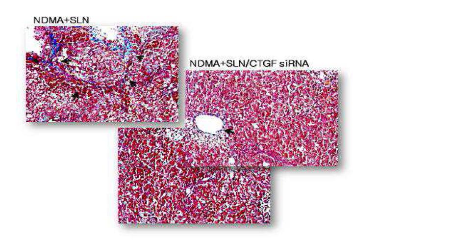 Masson’s trichrome staining of rat liver during NDMA- induced hepatic fibrosis and after concurrent