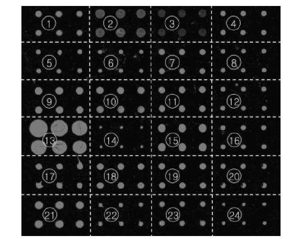 각각의 바이오마커에 대항하는 항체를 microarray chip에 배열한 모습.