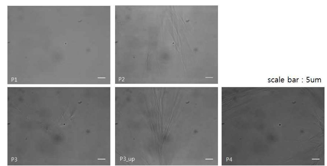 . (microscope image) 각기 다른 위치의 Type 1 Collagen fibril과 probe bead]