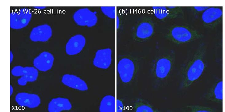 Molecular beacon을 이용하여 in situ 세포 이미징