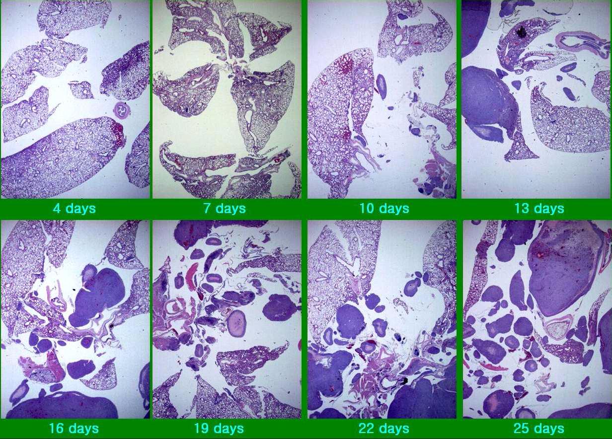 Microscopic features of the mouse lung.