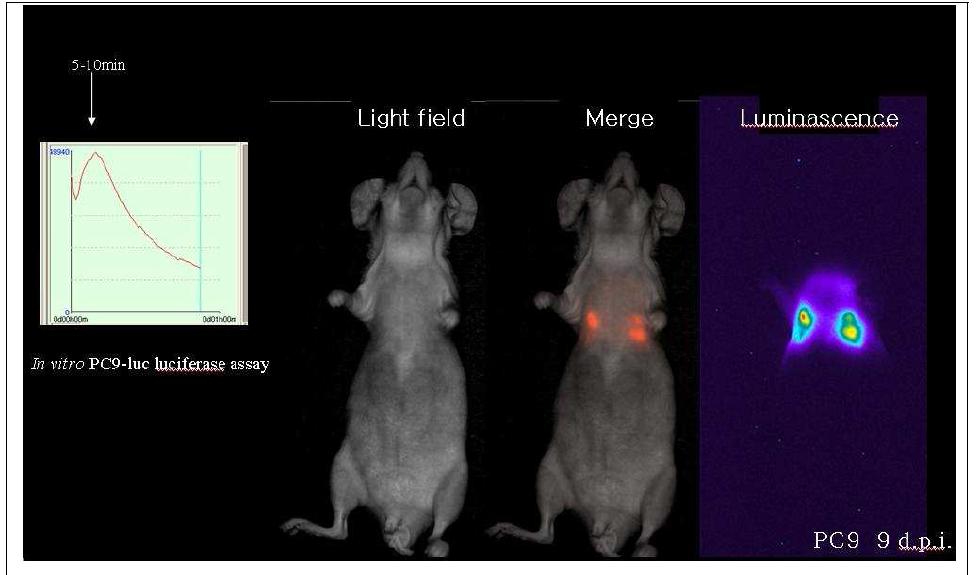 2- D optical imaging of orthotopic lung cancer model mouse induced by luciferase transfected PC9 adenocarcinoma cells.