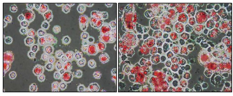 분화된 인간의 지방세포(왼쪽)와 마우스 지방세포(오른쪽)를 Oil Red O로 염색 하여 400배율로 관찰한 현미경 사진.