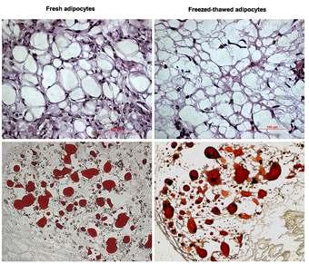 동결보관 전(좌),후(우)의 분화된 지방세포를 누드마우스 피하에 이식하고 4주 후 이 식부위를 생검하여 H&E 염색(위) 과 Oil Red O 염색(아래)을 실시 하여 400배율로 관찰한 사진.