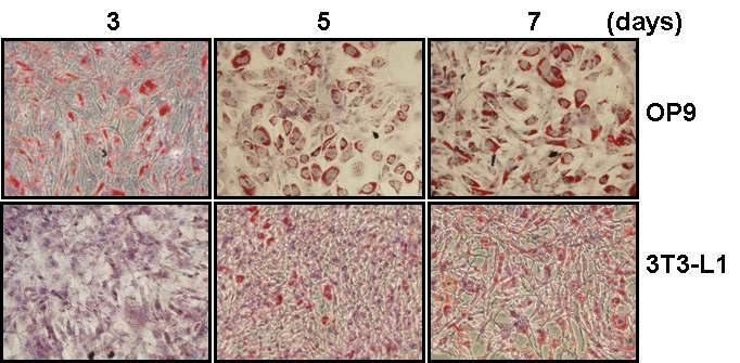 생쥐의 OP9과 3T3-L1 세포를 이용한 지방세포로의 분화