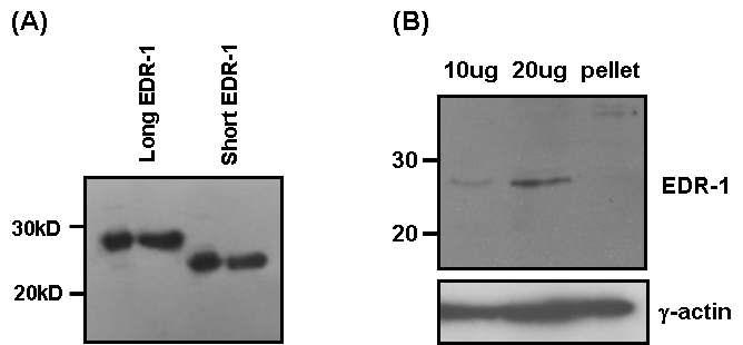 제작된 EDR-1 항체를 이용한 exogenous EDR-1과 endogenous EDR-1의 검출