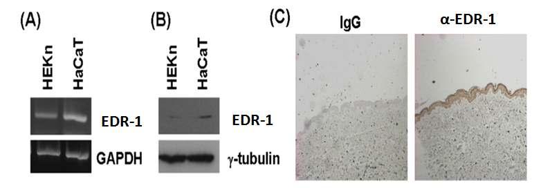 EDR-1 의 사람의 피부세포(keratinocyte)에서 발현 여부 확인 (A) RT-PCR, (B) Western blot (C) IHC