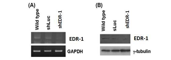 EDR-1유전자의 Knock down후 유전자 및 단백질 수준확인