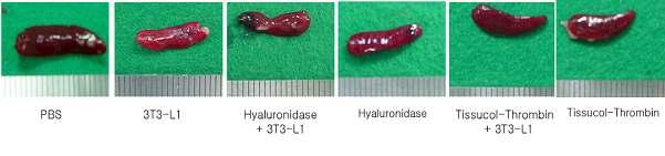 C57BL/6 마우스의 피하에 성숙한 지방 세포를 Adjuvant와 함께 이식 후 7일 후 분리한 spleen 크기 비교