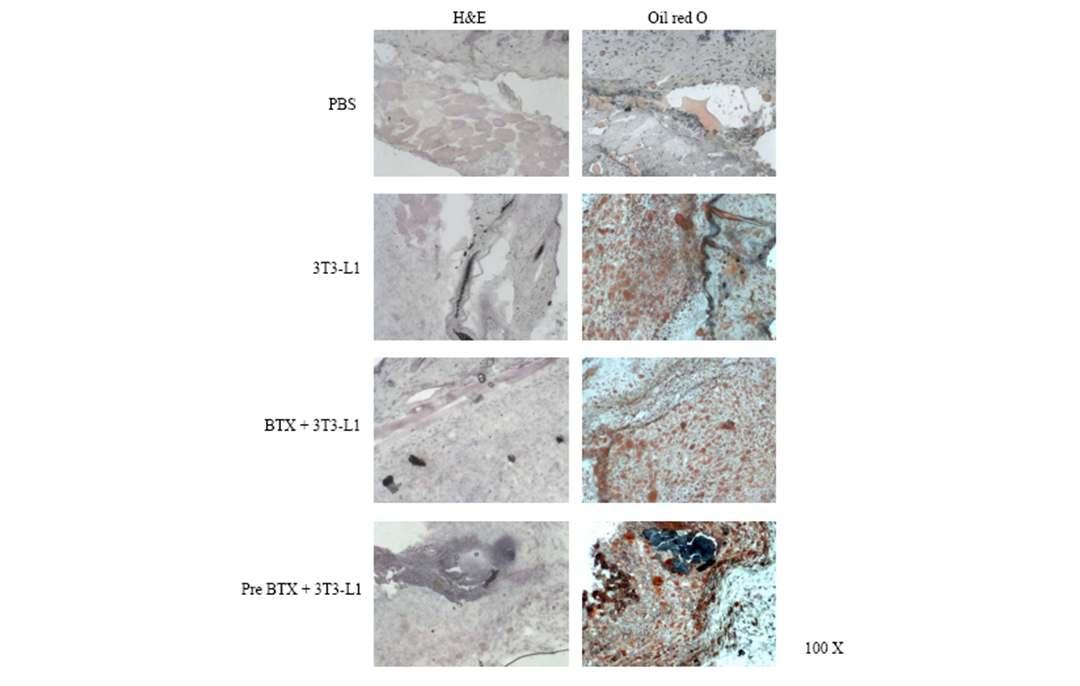 C57BL/6 마우스의 피하에 성숙한 지방세포를 Adjuvant와 함께 이식 후 6주 후 채취한 이식 부위의 조직학적 분석 (X100)