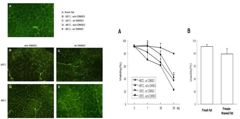 지방흡입수술 직후의 지방조직과 동결보관 후 녹인 지방조직을 AO/EtBr로 염색하여(살아있는 세포(녹색),