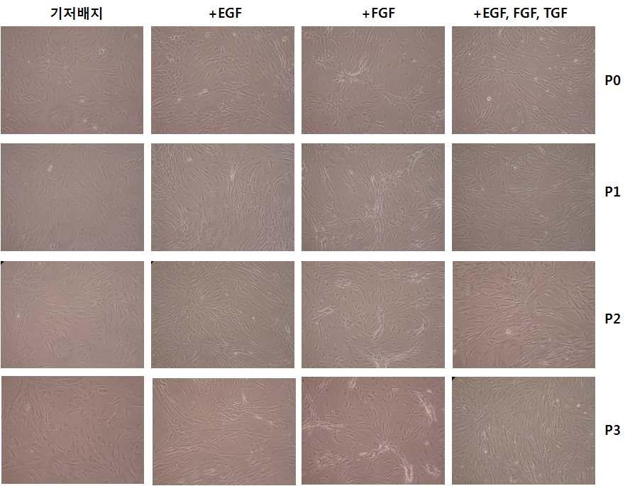 배양조건이 다른 지방줄기세포의 형태학적 관찰.