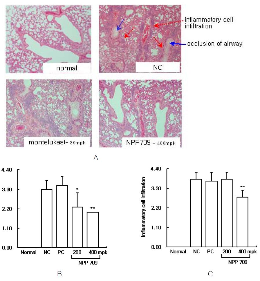 기도개형 유발된 마우스의 폐조직에서 AG NPP709의 기도폐색 및 염증세포 침윤억제 효과