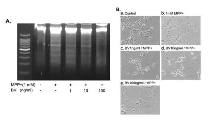 Effects of pretreatment with BV on MPP+ - induced DNA fragmentation and morphology
