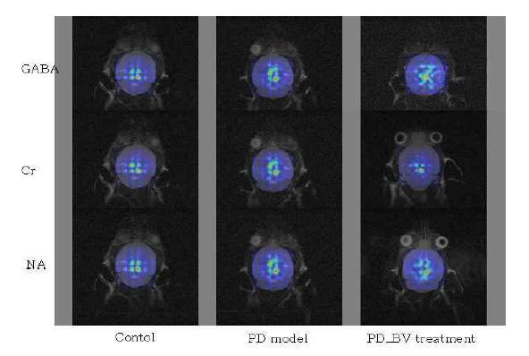 기저체(Basal ganglia) 전체를 측정한 뇌 대사물질(GABA, Cr, NAA) 변화량을 정상쥐(control)와 복강에 MPTP를 주입하여 만든 파킨슨질환 모델 생쥐(PD model)와 봉독을 슬관절 아래부분(양릉천)에 처치한 생쥐(PD_BV treatment)들의 MRSI 영상