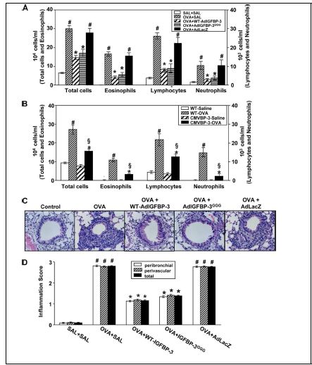 Figure 13. Effect of IGFBP- 3 on OVA- induced cellular components in mice.