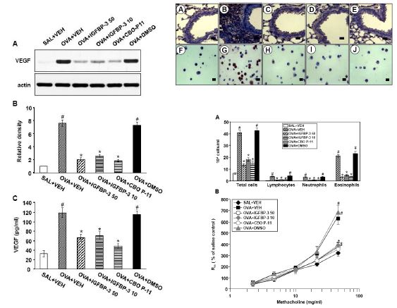 Figure 15. Effect of IGFBP- 3 or CBO- P11 on VEGF protein expression in lung tissues and BAL fluids and airway inflammation/hyperresponsiveness of OVA- sensitized and - challenged mice.