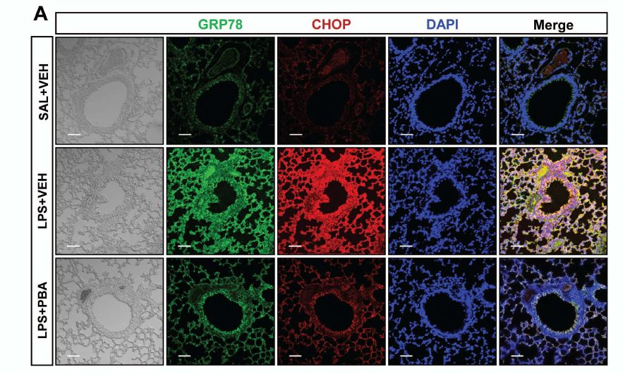 Figure 17. Representative confocal laser immunofluorescence photomicrography showed the expression of GRP78 protein (the middle- left panels, green fluorescence views) and CHOP protein (the middlepanels, red fluorescence views) in SAL+VEH (the upper panels), LPS+VEH (the center panels), orLPS+PBA (the bottom panels). Bars indicate scale of 50 μm.