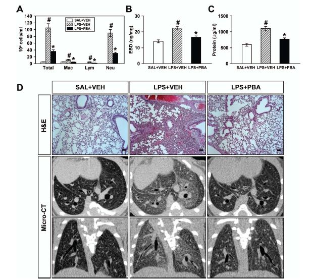 Figure 18. Effects of 4- PBA on the differential cellular components (A), plasma exudation using EBD assay (B), total protein amounts (C) in BAL fluids, and pathologic and radiologic changes (D) of LPS- treated mice