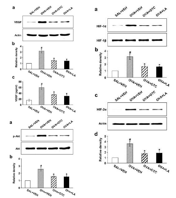 Figure 9. I. Effect of OTC or LA on VEGF expression in lung tissues and in BAL fluids.