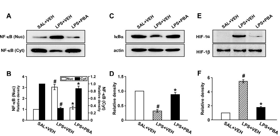 Figure 12. Effects of 4- PBA on the activations of NF- kB/ IkBα p65 and on the HIF- 1a protein levels in lung tissues of LPS- treated mice.