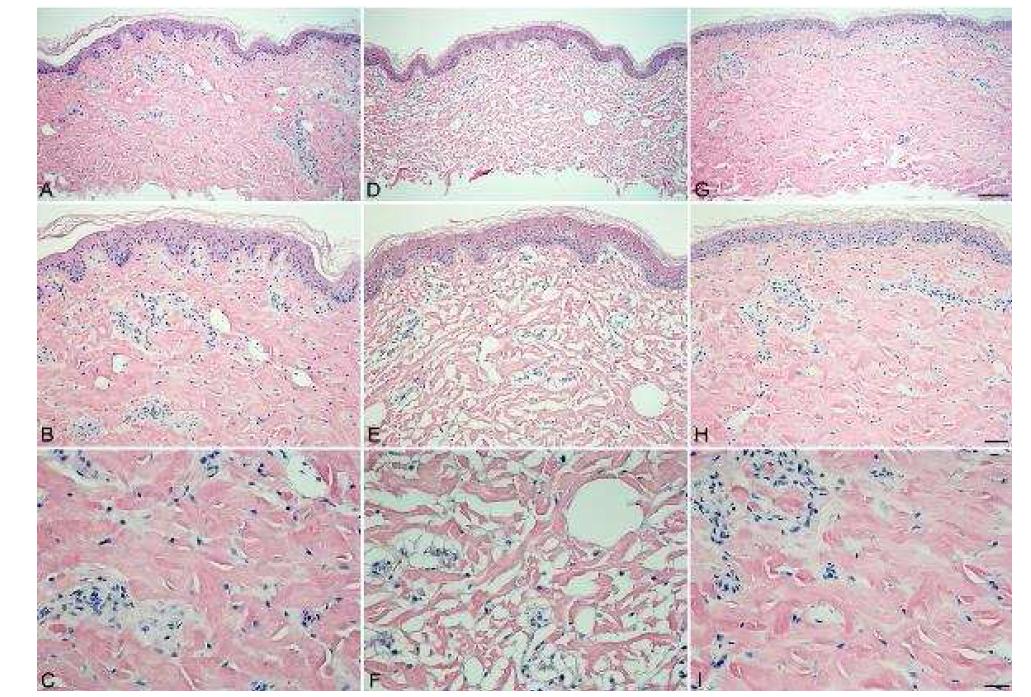 Histopathological analysis by HE staining of porcine skin