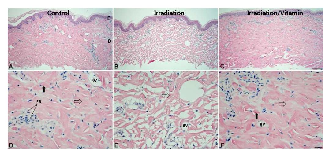 Histopathological analysis by HE staining of porcine skin