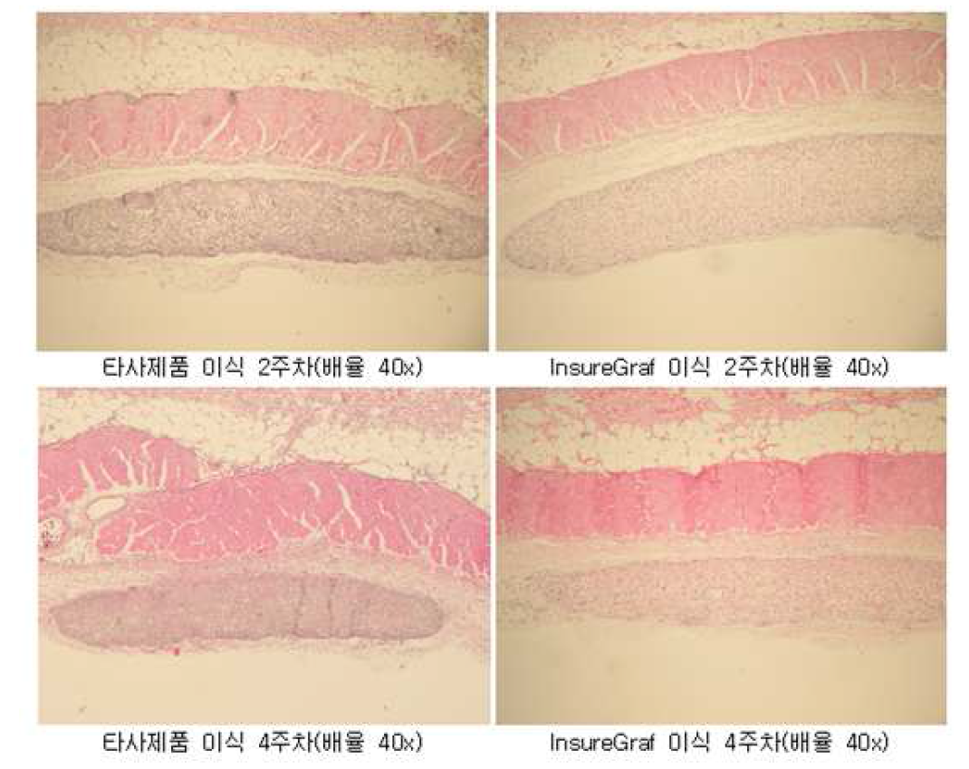 동물 이식을 통한 lisureGraf의 타사제품 대비 동등이상 분해내성확인