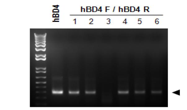 역유전학 방법으로 제작한 재조합 바이러스의 genome 내에 hBD4 유전자의 존재유무 확인