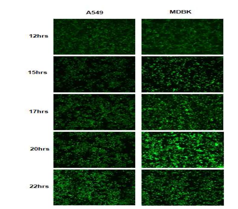 GFP 발현의 현미경적 관찰