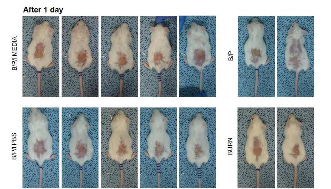 화상을 입힌 뒤 1일째 사진