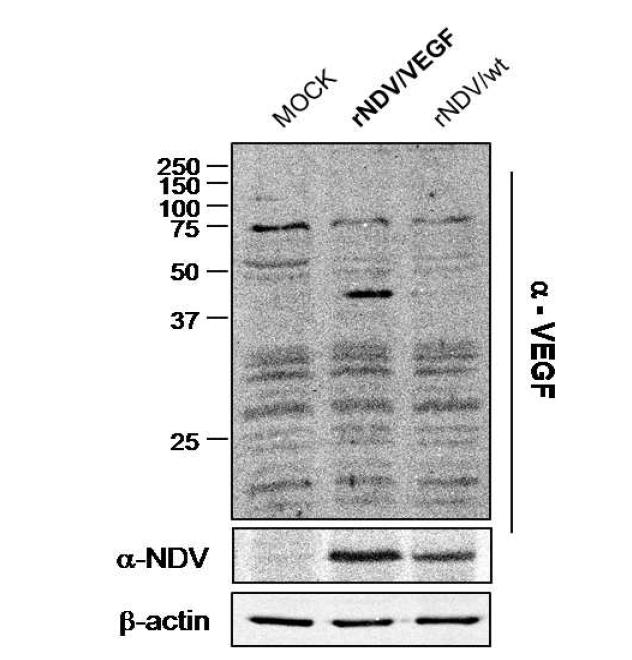 rNDV/hVEGF를 감염시킨 fibroblast 세포에서 발현되는 hVEGF 단백질 발현 확인 (Westen blot)