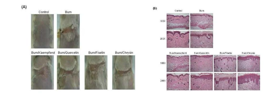 끓는 물로 마우스의 피부에 화상을 유발한 후, 21일 동안 flavonoid들을 처리 한 마우스의 사진(A) 과 피부 조직 H&E 염색 (B) 결과