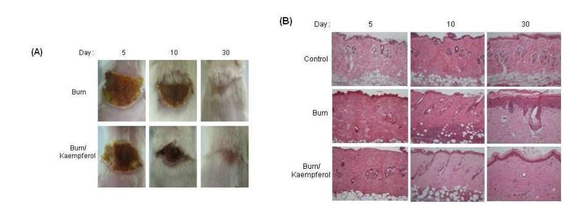 끓는 물로 마우스의 피부에 화상을 유발한 후, 30일 동안 kaempferol을 매일 도포한 마우스의 사진(A) 과 피부 조직 H&E 염색 (B) 결과